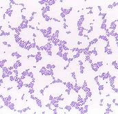 Image result for Cluster of Warts