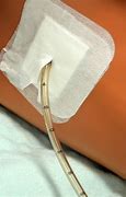 Image result for Chest Tube Collection