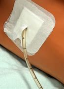Image result for Chest Drainage Bag