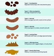 Image result for Stool Texture Chart