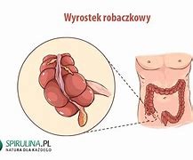 Image result for co_oznacza_zapalenie_wyrostka_robaczkowego