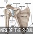 Image result for Mechanical Ball and Socket Joint Examples