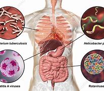 Image result for Microbes Infections