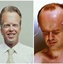 Image result for Biggest Forehead World Record