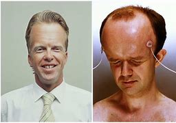 Image result for Biggest Head in the World