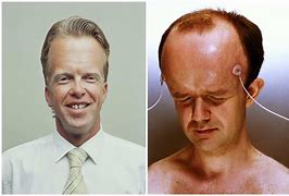 Image result for World's Biggest Head On a Human