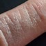 Image result for Silicone Phone Case Allergy On Hands