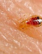 Image result for Small Black Bed Bugs