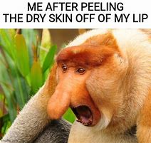 Image result for Dry Skin Meme