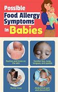 Image result for Food Allergy Rash in Toddlers