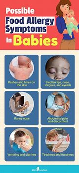 Image result for Baby Food Allergy Symptoms