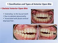 Image result for AOB Dental