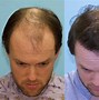 Image result for Hair in the Year 3000