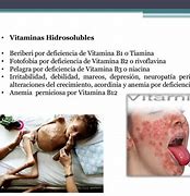 Image result for avitaminosis