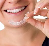 Image result for Invisible Braces for Adults