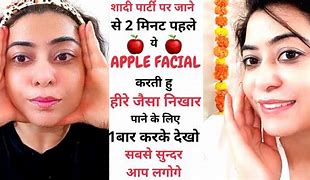 Image result for Apple Allergy Face Swelling