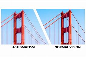 Image result for Astigmatism What It Looks Like
