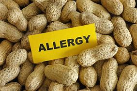 Image result for Peanut Allergy Reaction