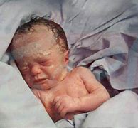 Image result for Baby Born with No Head