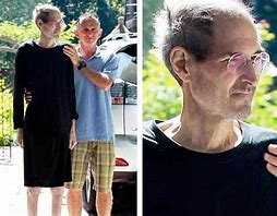 Image result for Steve Jobs Before and After Cancer