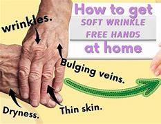 Image result for Hand with No Skin