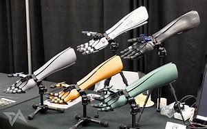 Image result for Robotic Arm Human Prosthetic