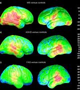 Image result for Brain Sizes Smallest to Largest