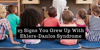 Image result for Ehlers-Danlos Syndrome Symptoms