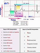 Image result for EKG Interpretation