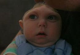 Image result for Baby Born without a Brain S