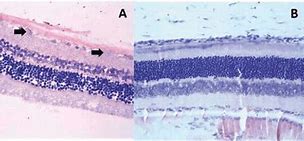 Image result for Retinal Ganglion Cells Cytology