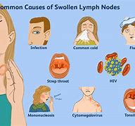 Image result for Women with Throat Cancer