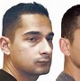 Image result for Small Chin Men