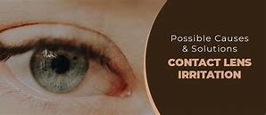 Image result for Contact Lens Irritation