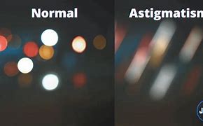 Image result for Optical Astigmatism