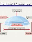Image result for Contact Lens Orientation