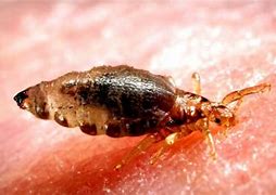 Image result for What Does a Brown Lice Look Like