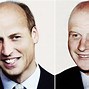 Image result for Prince William Losing Hair