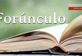 Image result for for�nculo