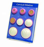 Image result for How to Check Cervix Dilation
