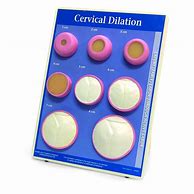 Image result for Cervical Dilation Simulator