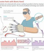 Image result for prosthetics hands sensory feedback