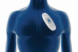 Image result for Wearable Cardiac Monitoring Devices