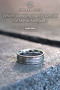 Image result for Nickel Allergy Wedding Ring