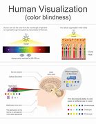 Image result for Eye Cone Problems