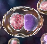 Image result for Chlamydia Infection Images