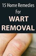 Image result for Home Remedies for Flat Warts