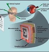 Image result for Human Augmentation Technology with Retina Display