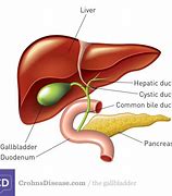 Image result for organ gall-bladder   image
