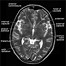 Image result for Head and Brain Outline